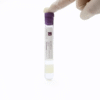 8ml HA PRP Tube