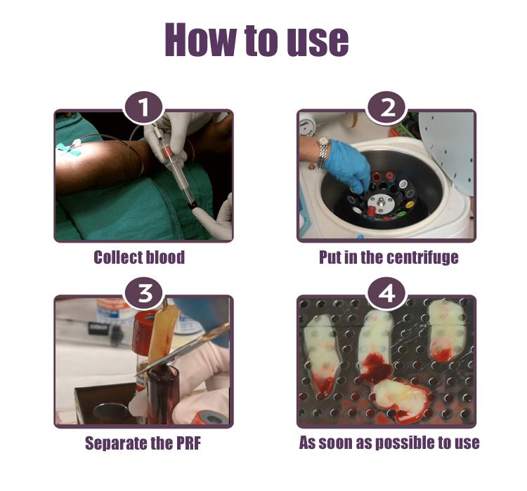 PRF Tube