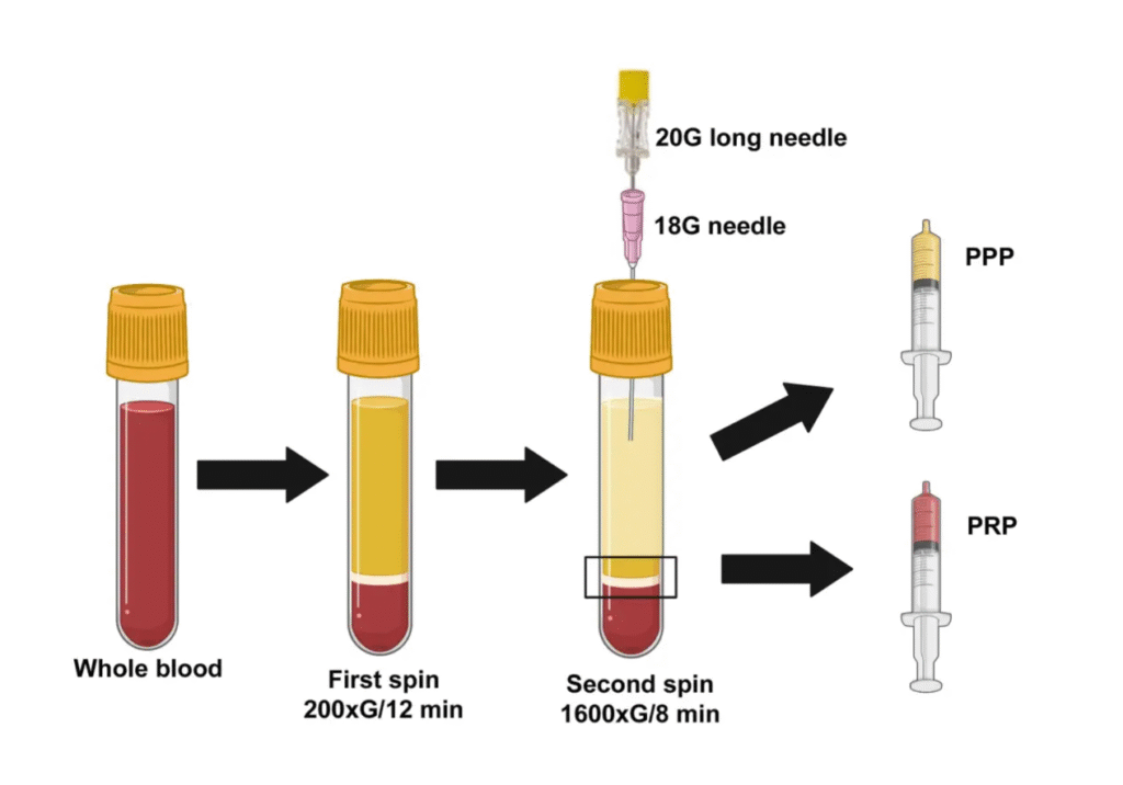 12ML PRP Tube 12ML PRP Tube