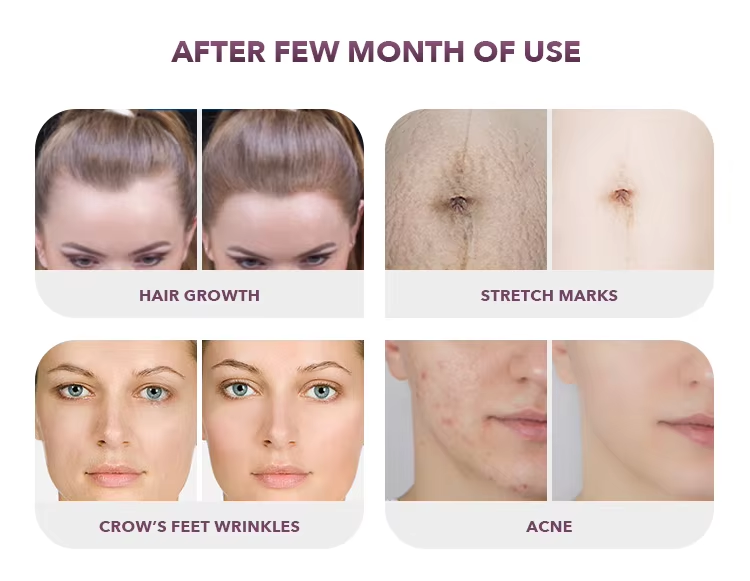 Dermapen A12 Precision Therapy
