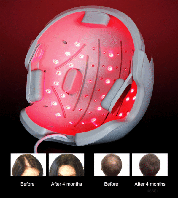 Hair Helmet Hair Growth Laser Therapy Cap