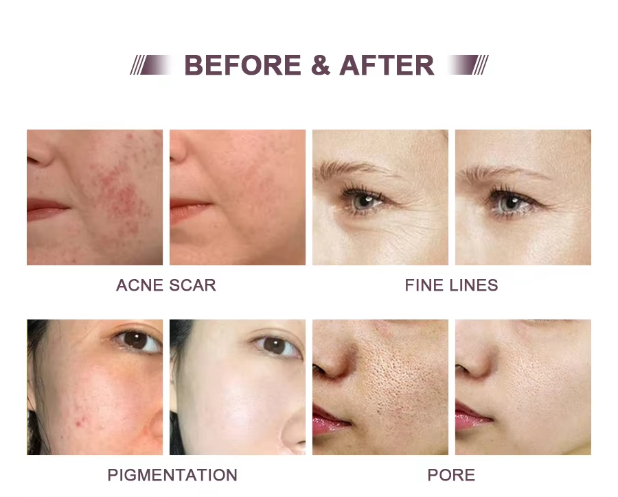 Meso Serum